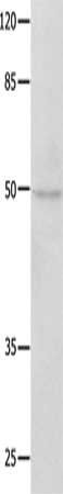 NAP1L1 Antibody