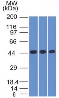 Napsin A (Lung Adenocarcinoma Marker) Antibody