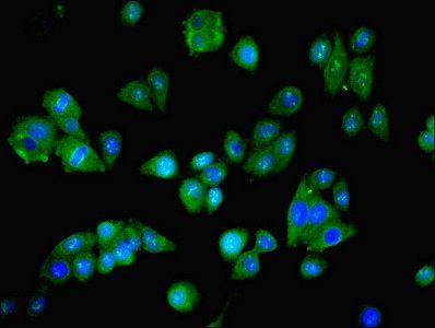 NARS Antibody