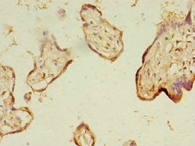 NARS2 Antibody