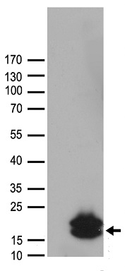 NAT1 Antibody