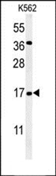 NAT13 antibody