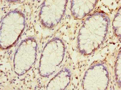 NAT2 Antibody