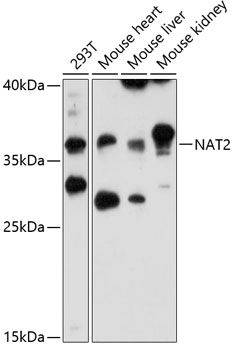 NAT2 antibody