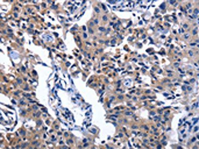 NAT8 Antibody
