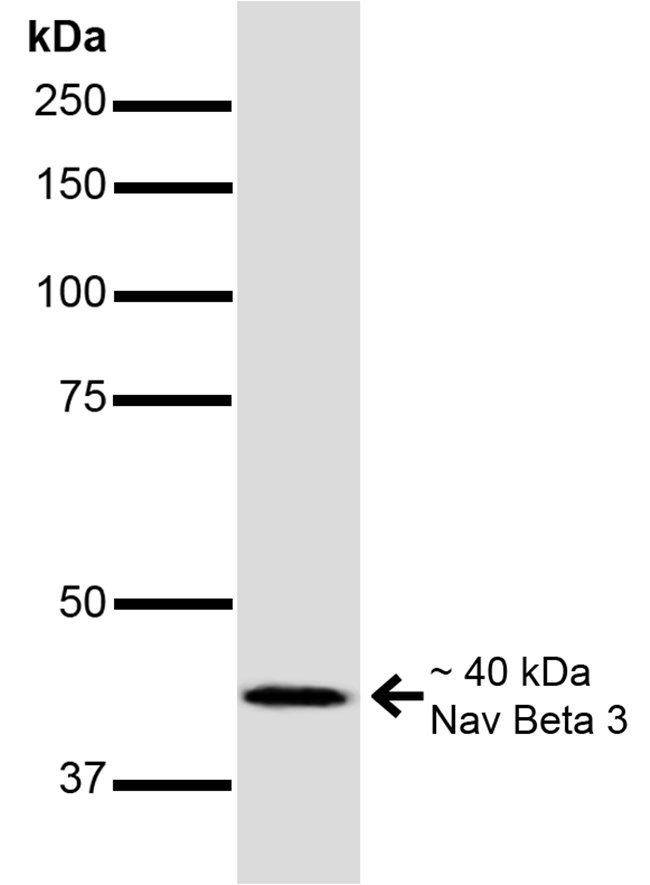 NaVbeta3 Antibody