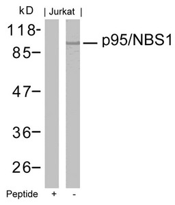 NBN (Ab-343) antibody