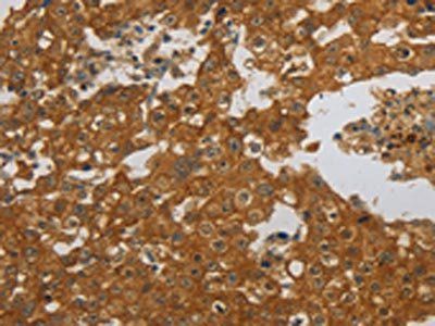 NBN Antibody