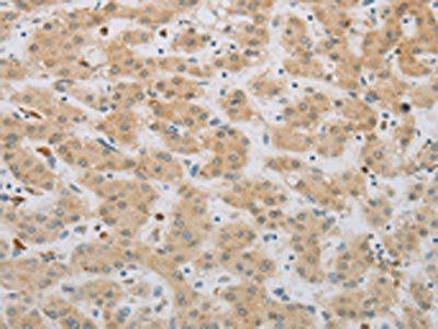 NBN Antibody