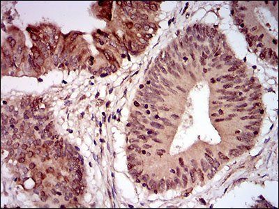 NBN Antibody