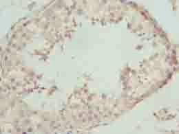 NBPF3 Antibody