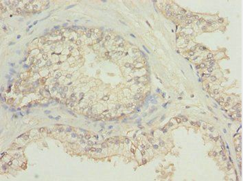 NBR1 Antibody