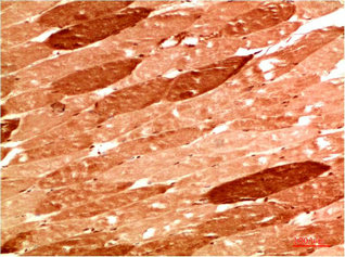 NBR1 Antibody