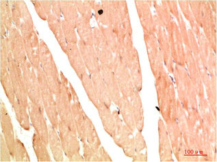 NBR1 Antibody