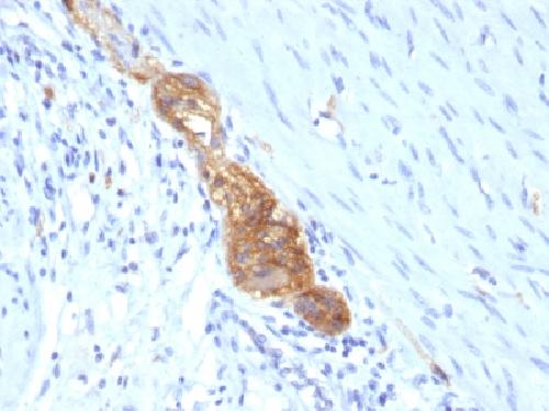 CD56 / NCAM1 (Neuronal Cell Marker) Antibody