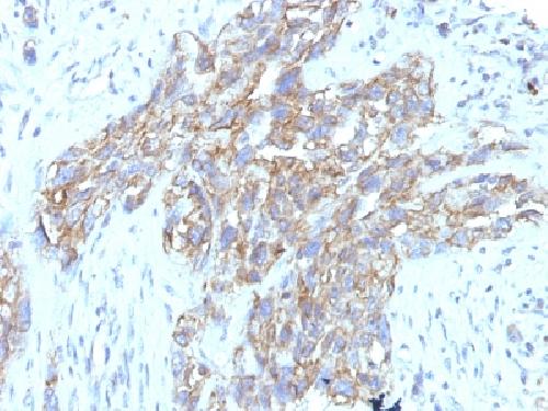 NCAM1 antibody