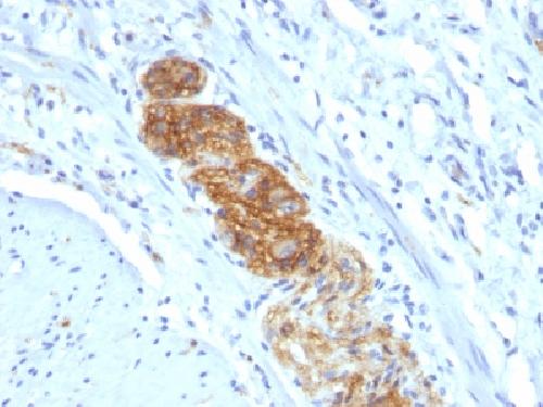 NCAM1 Antibody