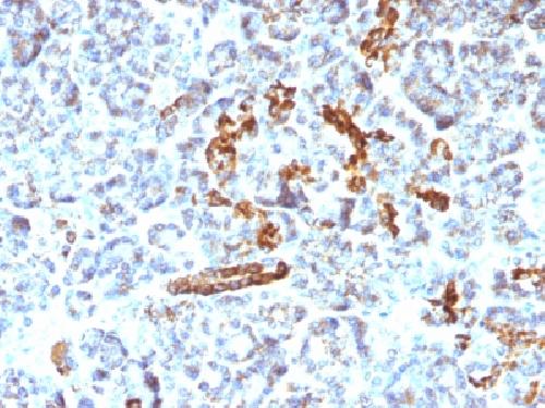 CD56 / NCAM1 / NKH1 (Neuronal Cell Marker) Antibody