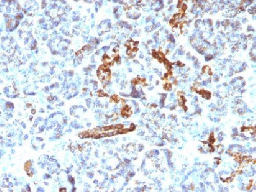 NCAM1 antibody