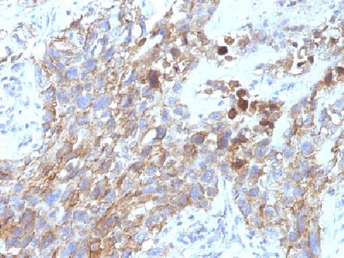 NCAM1 antibody