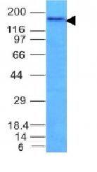CD56 / NCAM1 / NKH1 (Neuronal Cell Marker) Antibody