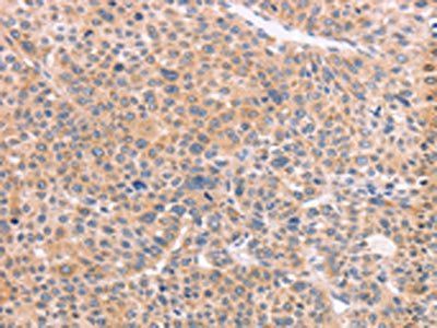 NCAM1 antibody