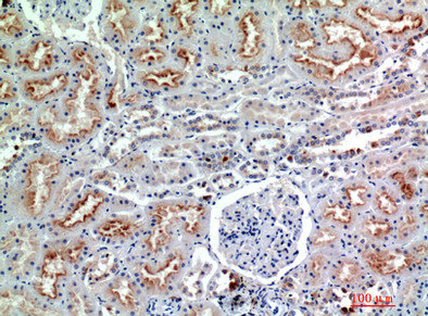 NCAM1 Antibody