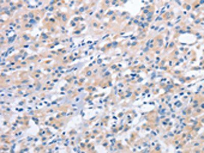 NCAPD2 antibody