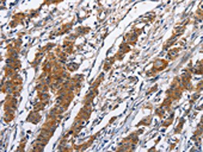 NCAPD3 Antibody