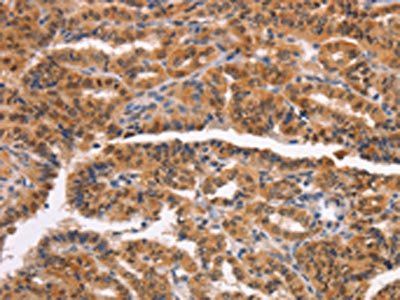 NCAPG2 antibody