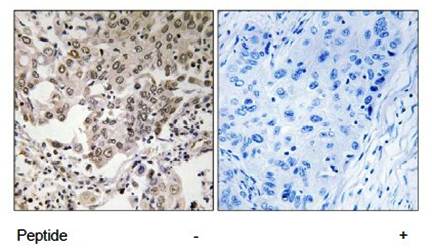 NCAPG2 Antibody
