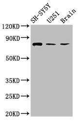 NCDN antibody