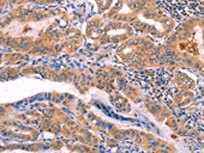 NCEH1 Antibody