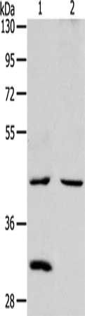 NCEH1 antibody