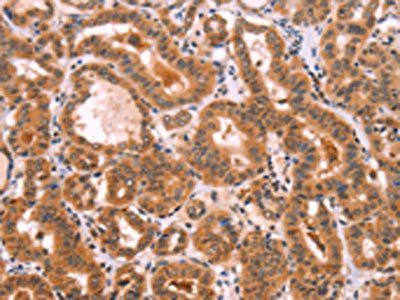 NCEH1 Antibody