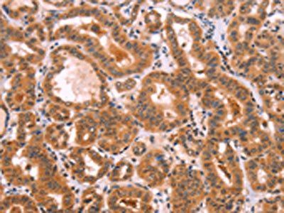 NCEH1 antibody