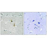 NCF1 Antibody