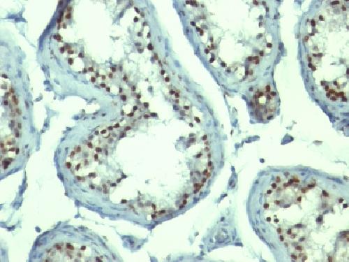 NCL antibody