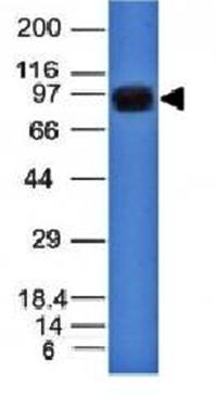 NCL antibody