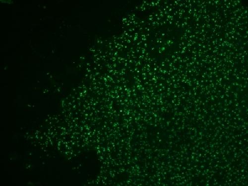 Nucleolin (Marker of Human Cells) Antibody