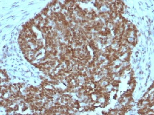 Nucleolin (Marker of Human Cells) Antibody
