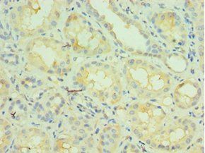 NCOA4 Antibody