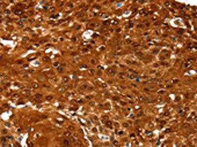 NCOR1 antibody