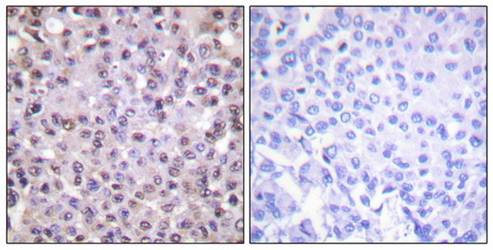 NCoR1 Antibody