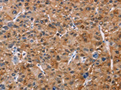 NCR3 Antibody