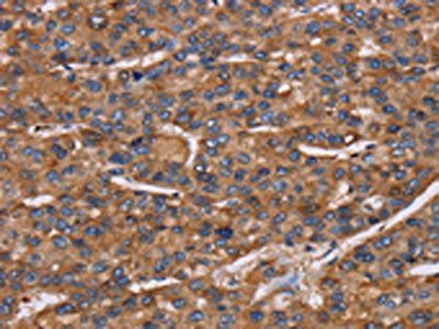 NCSTN Antibody