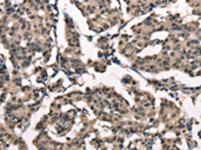 NDNL2 Antibody