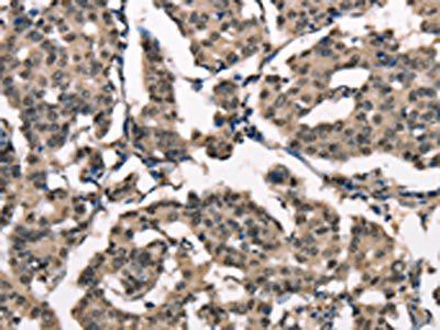 NDNL2 antibody