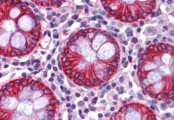 Goat anti-NDRG1 Antibody
