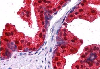 Goat anti-NDRG1 Antibody